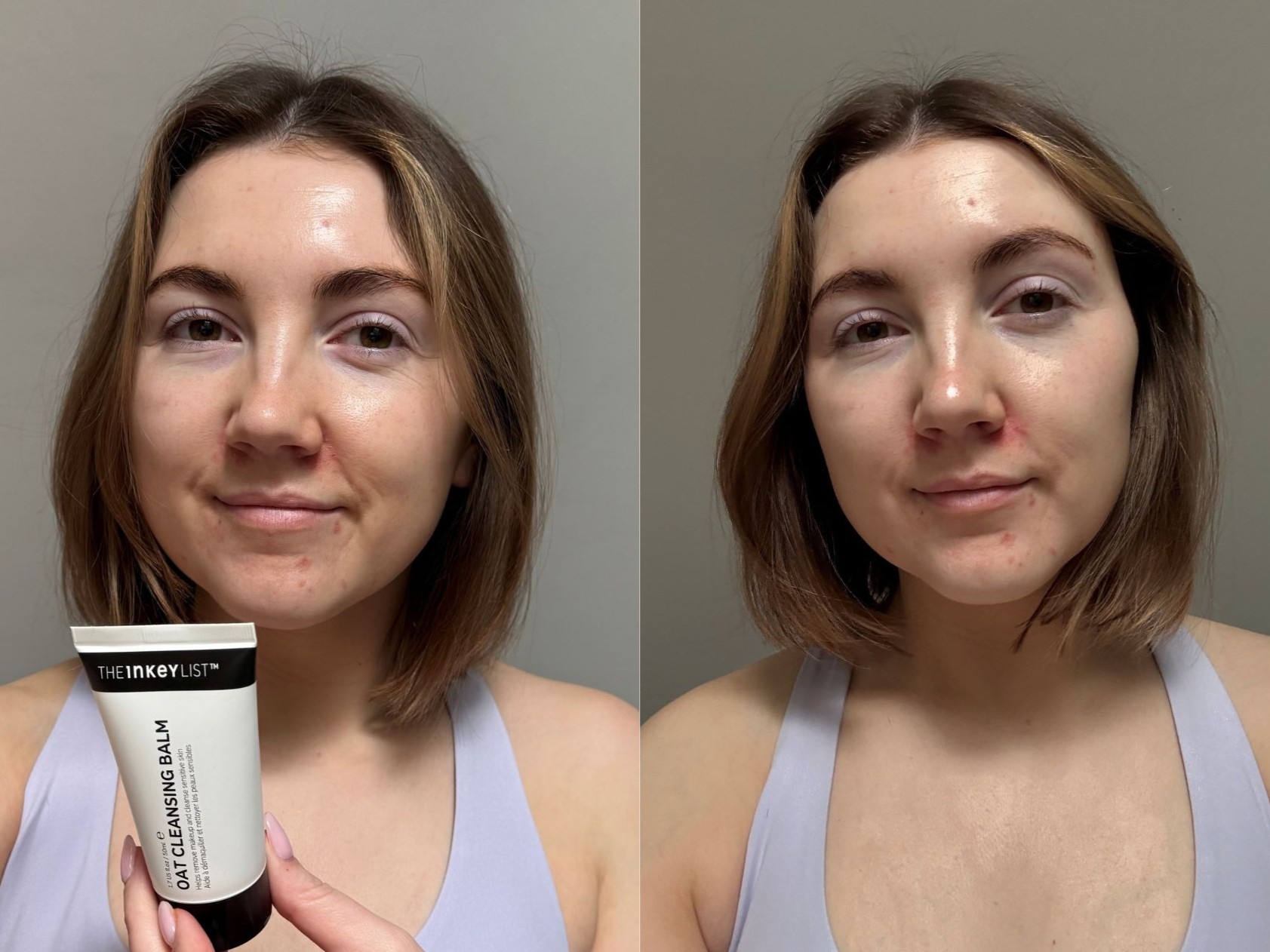 Charlotte Inkey Cleansing balm before and after